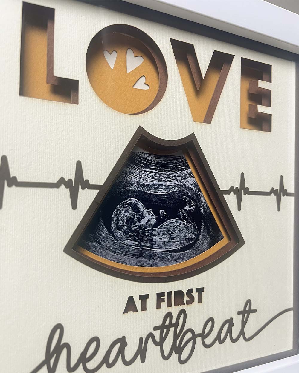 Pregnancy