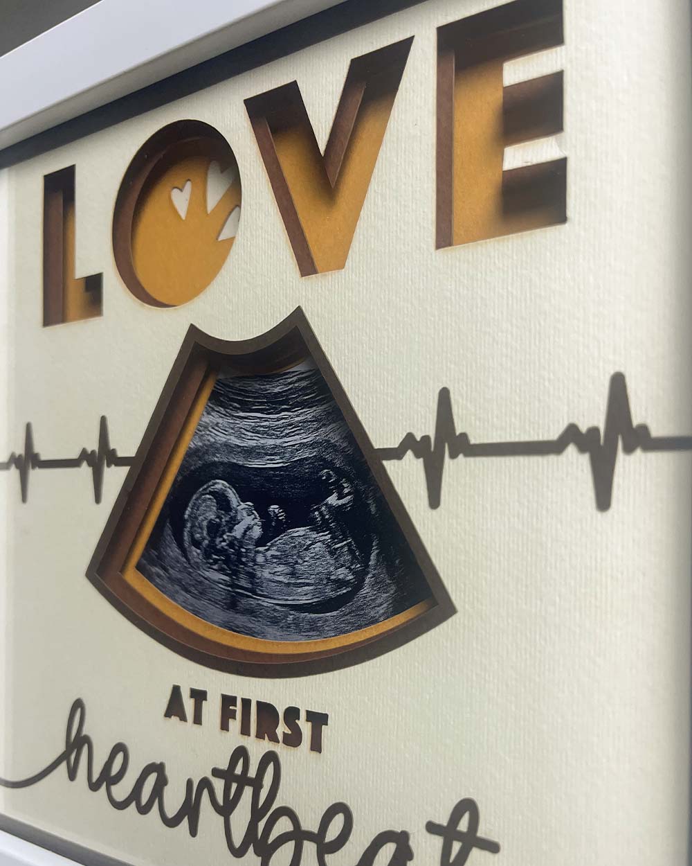 Pregnancy